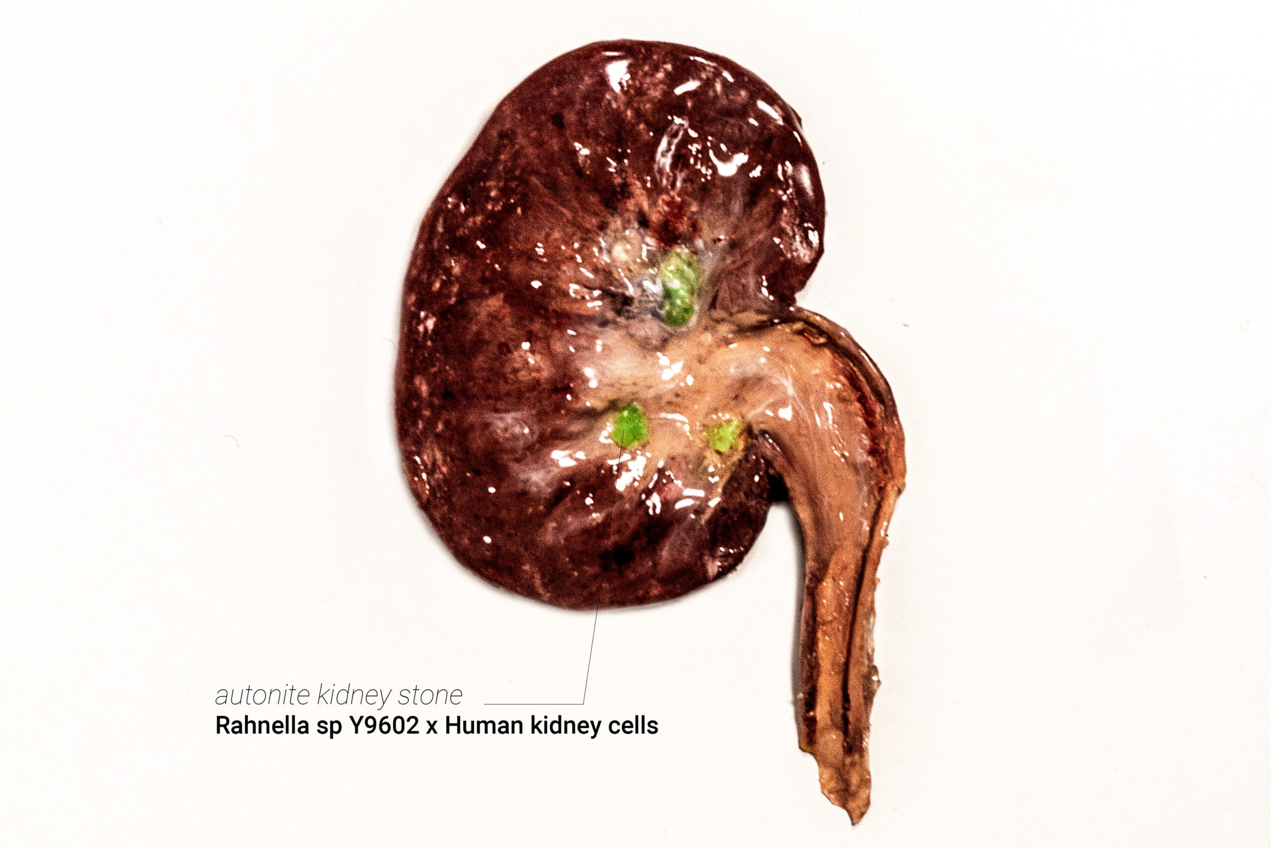 6.uraniumxkidney2-2