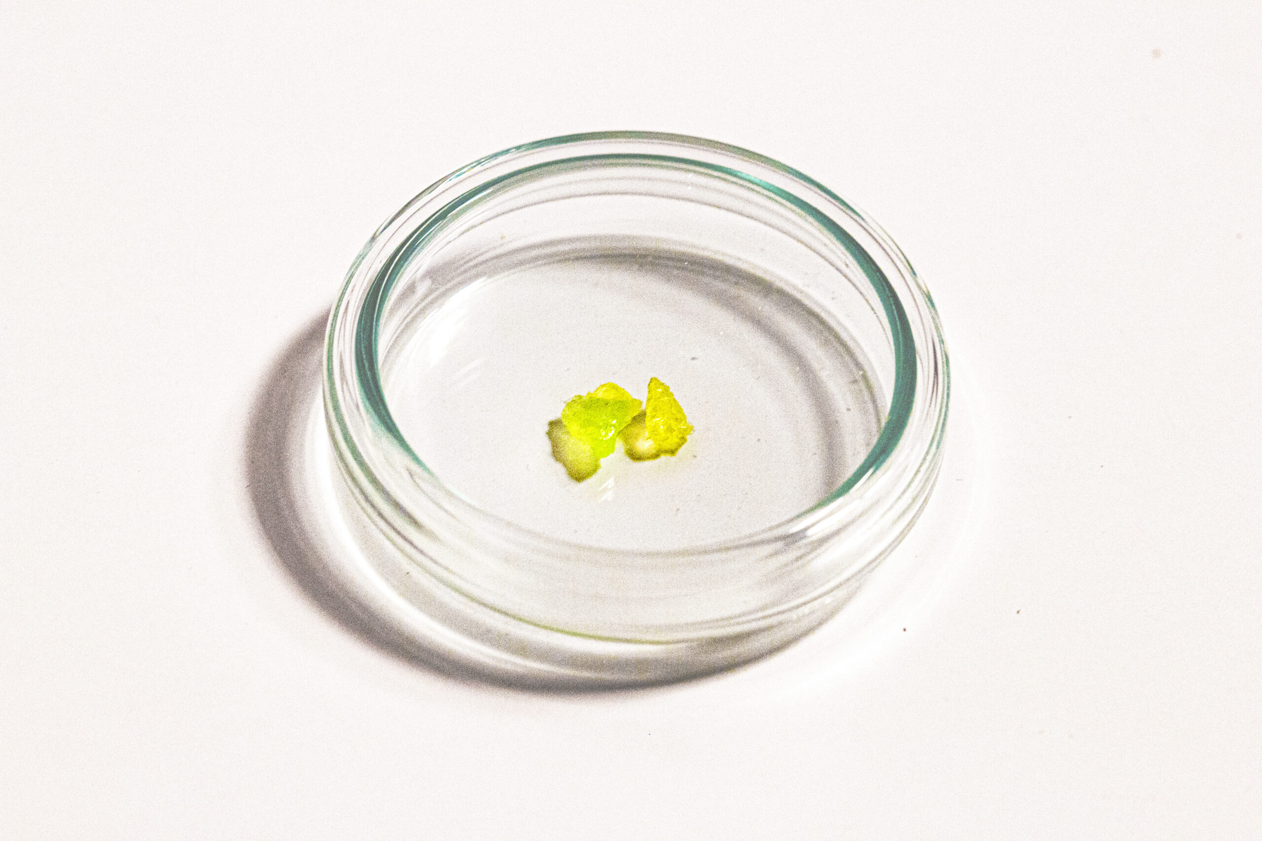 6.uraniumxkidney2